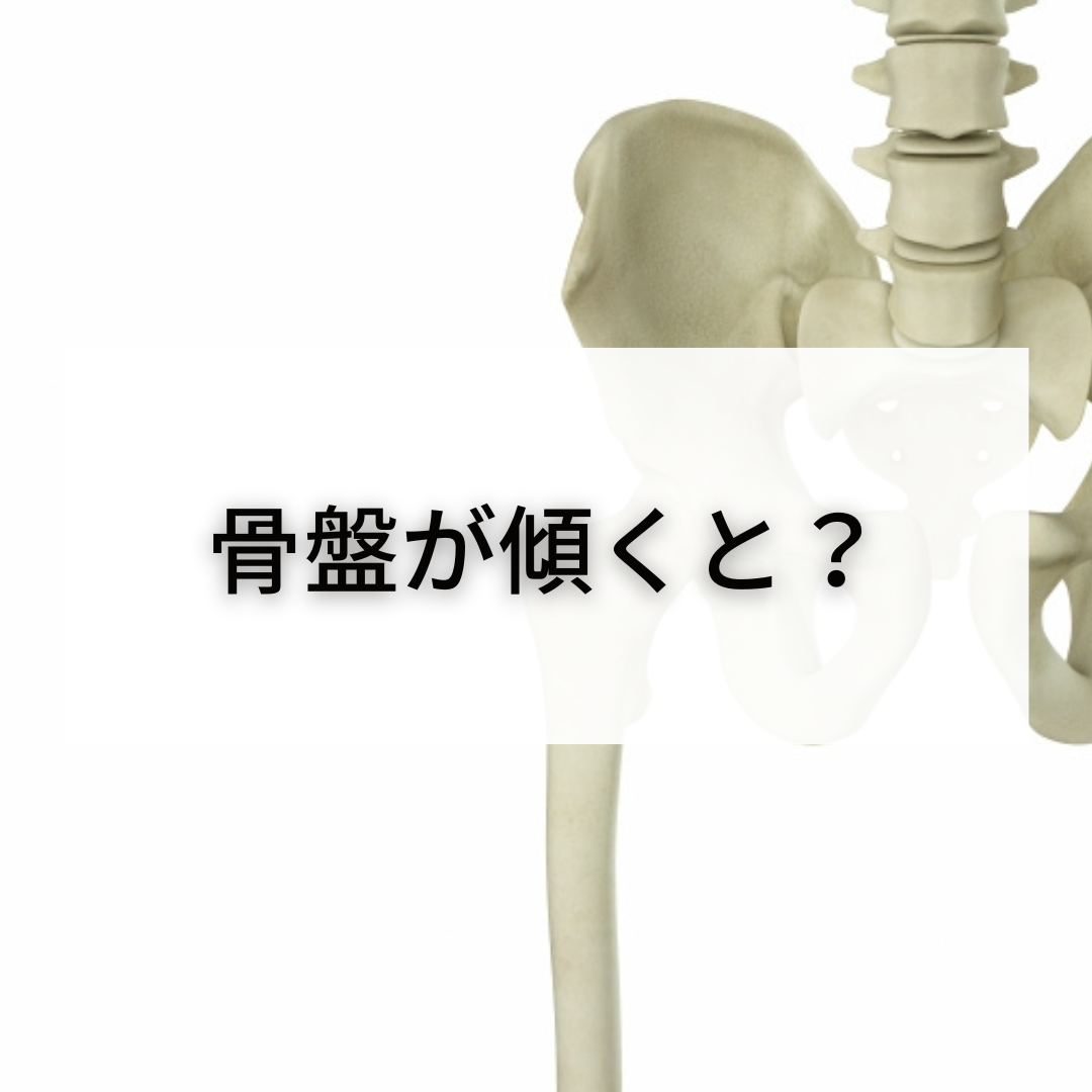 【徹底解説】骨盤が傾くと？ | パーソナルジム｜ワイズジム恵比寿